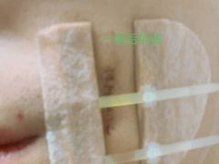 -杭州市第三人民医院