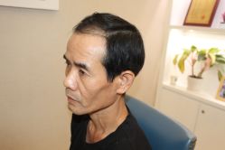 -大麦微针植发丨全国连锁