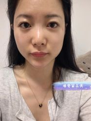 体验后-深圳芙必优医疗美容·抗衰中心
