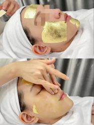 -skin79皮肤管理中心