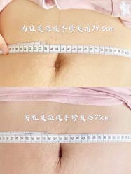 -梦斯绮私密催乳修复中心