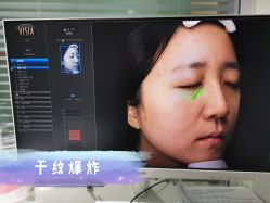 -和颜一美轻医美连锁