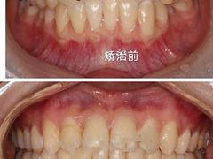 -团圆口腔·种植中心(锦江院区)