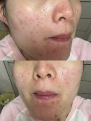 -彼家美创·量肤定制修护管理