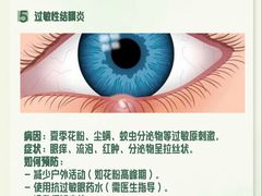 -黑马眼科·近视手术
