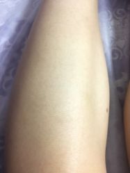 -薇兰专业脱毛连锁机构