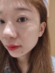 体验前-康美贞·痘肌养护管理中心