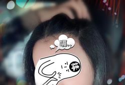 -大麦微针植发全国连锁