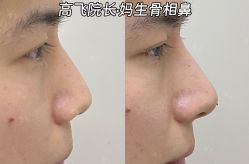 -深圳艺星医疗美容医院