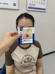 -大麦微针植发全国连锁