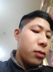 -痘博士天津·全国连锁祛痘机构