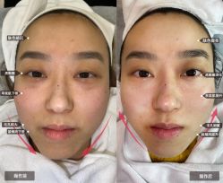 -SKIN79皮肤管理中心