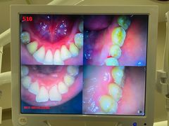 -土豆口腔(凤凰北总店)