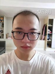 -雍禾植发全国连锁