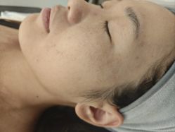 -skin79皮肤管理中心