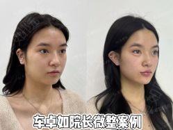 -Yestar重庆艺星医疗美容医院