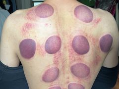 -来康盲人按摩(惠民北街店)