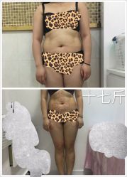 -摩瘦纤体订制减肥