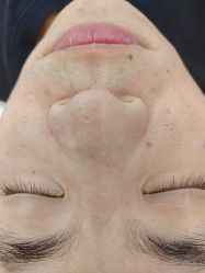 -蕾特恩专业祛痘·皮肤管理