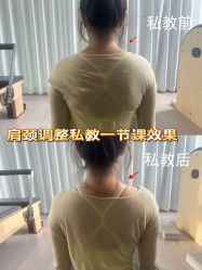 -小黑裙瑜伽·普拉提