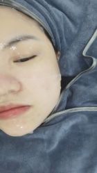 体验后-深圳医恒美医疗美容