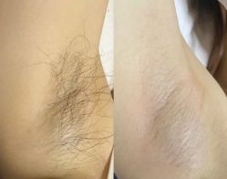 点击看大图 -瓷肌博士·祛痘科技美肤