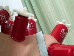 -孟氏拔罐(纬一路店)