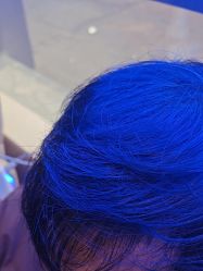 -碧莲盛·不剃发植发