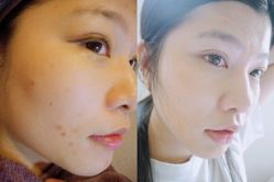-SKINIST丽铂医疗美容