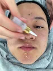 点击看大图 -SKIN79皮肤管理中心