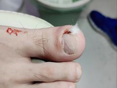 -新甲连锁灰指甲·甲沟炎·鸡眼(黑龙江路店)