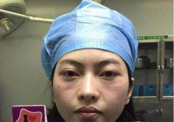 -天津健丽·去眼袋医疗美容机构