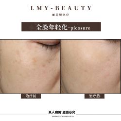 -丽美妍医疗美容·皮秒·立体分层抗衰