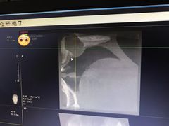 -哈尔滨医科大学附属第一医院(南岗院区)