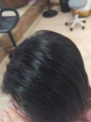 -碧莲盛·不剃发植发