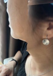 点击看大图 -广州美莱医疗美容医院