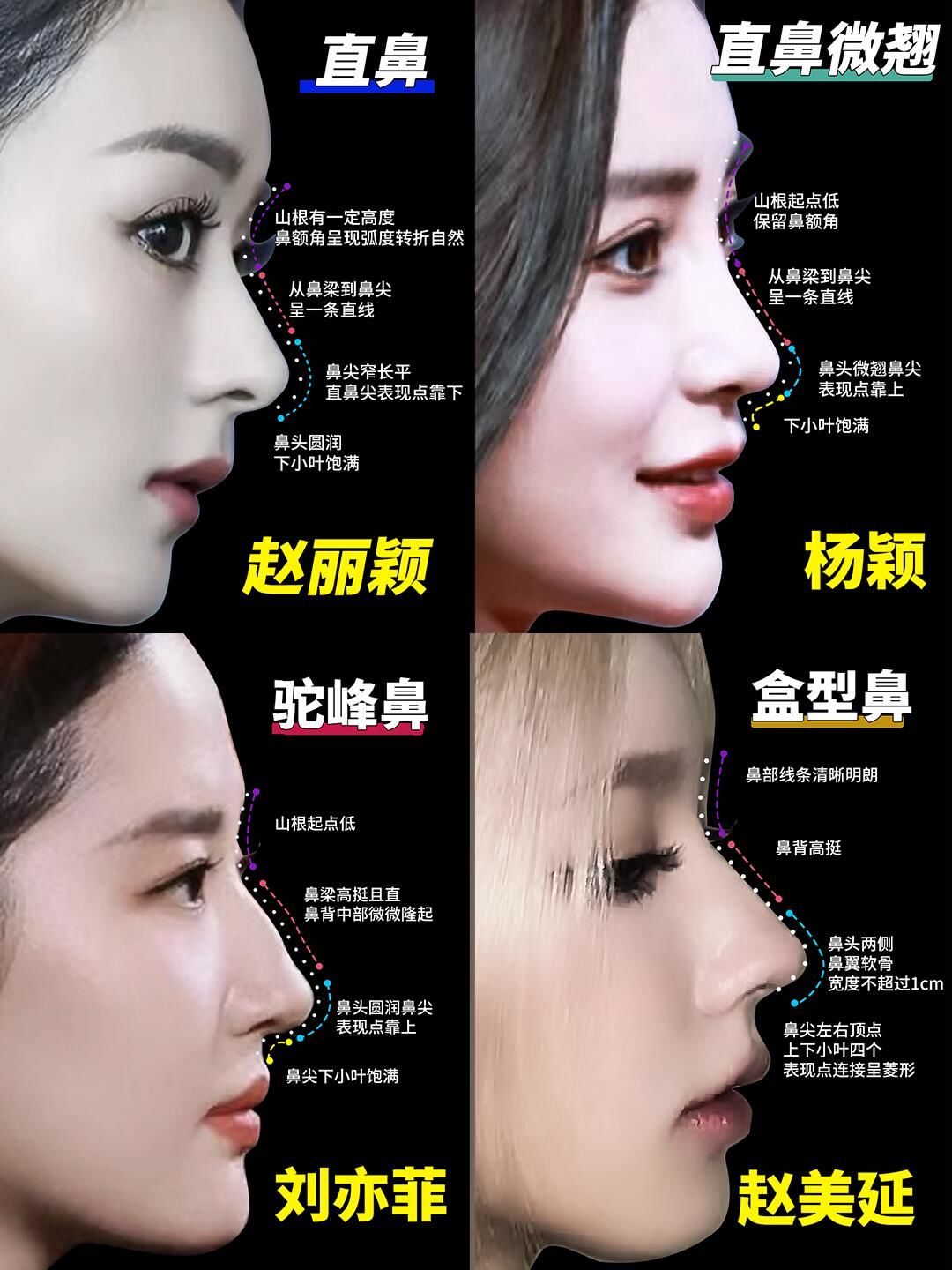 明星同款美鼻模板✨
 
宝子们是不是总羡慕女明星们精致的鼻子?