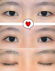 -东莞西妃整形美容医院