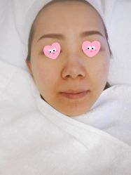 体验前-JS医疗美容