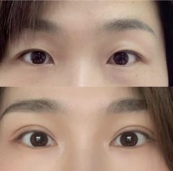 -郡艺医疗美容·微整·眼鼻吸脂