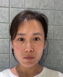 -上海时光整形外科医院