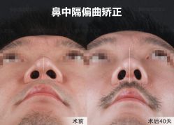 -北京米扬丽格医疗美容·联合丽格鼻整形中心