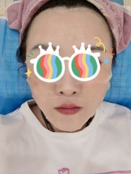 体验后-新美荟医美·专注面部美学抗衰