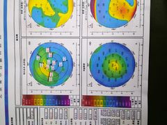-美尔目眼科医院·近视手术·儿童近视(通州店)