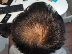 -章光101防脱养发荟