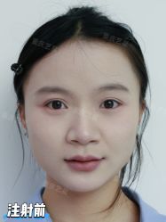 -Yestar重庆艺星医疗美容医院