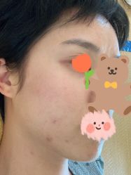 体验后-深圳广和门诊部·整形医疗美容