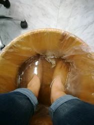 点击看大图 -派恩宜灰指甲·甲沟炎·鸡眼康护
