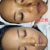[胜利]凝时驻颜套组