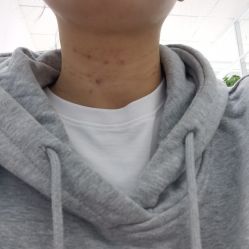 体验后-JS医疗美容